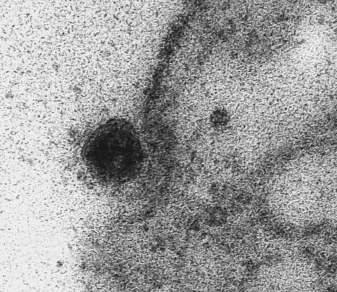 coronavirus