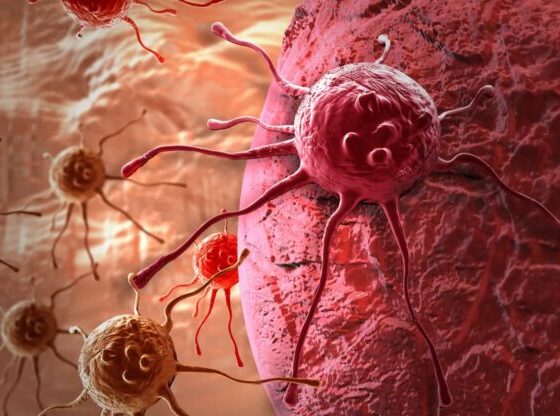 5 cánceres más mortíferos del mundo