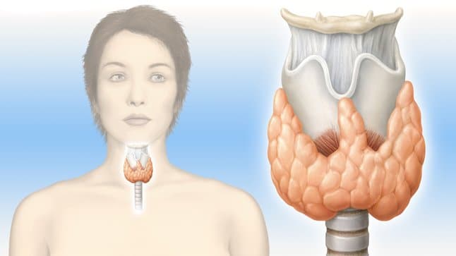Hipotiroidismo Síntomas, Causas y Tratamiento