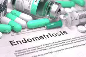 9 Mitos y verdades sobre la endometriosis