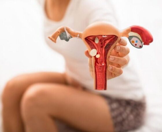 9 Mitos y verdades sobre la endometriosis